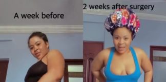 Kisa Gbekle Flaunts Her Before And After Surgery Body In New Video